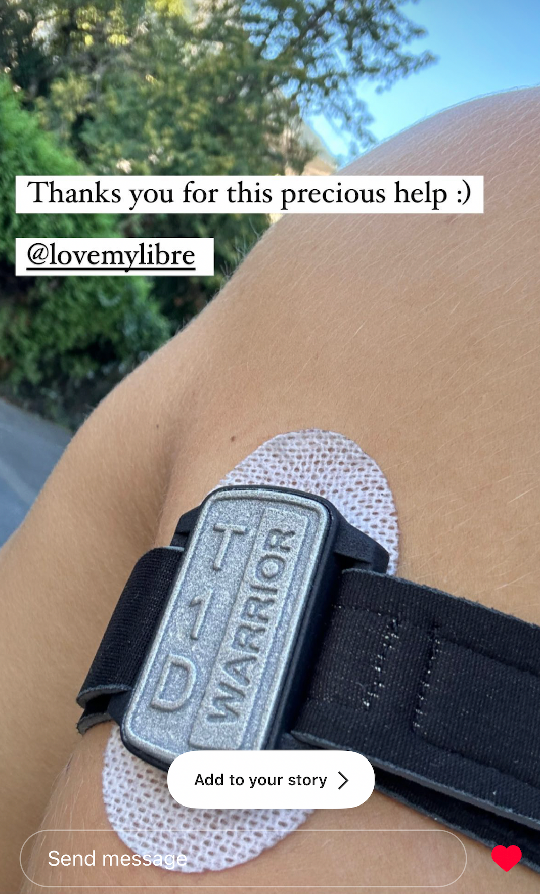Customer wearing pewter Dexband with T1D Warrior style, on upper arm. From Instagram post.