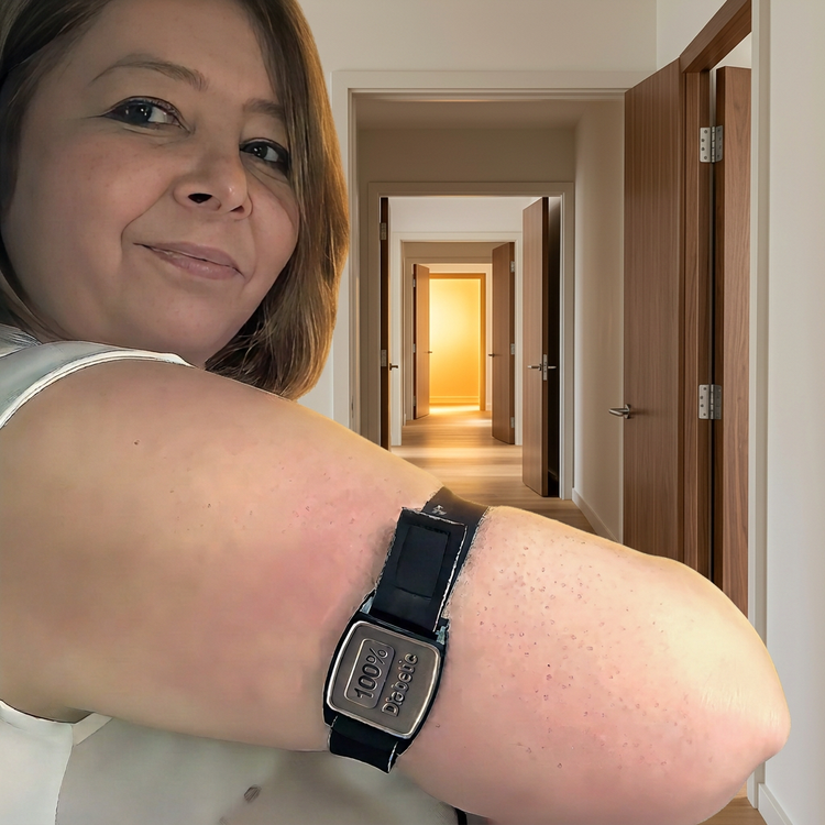 Dexband CGM Armbands